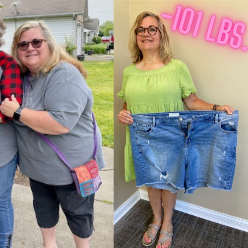 Success Stories Cincinnati, OH and Florence, KY Weight Loss Center