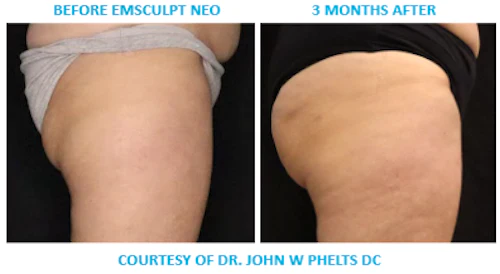 Overall Patient Results