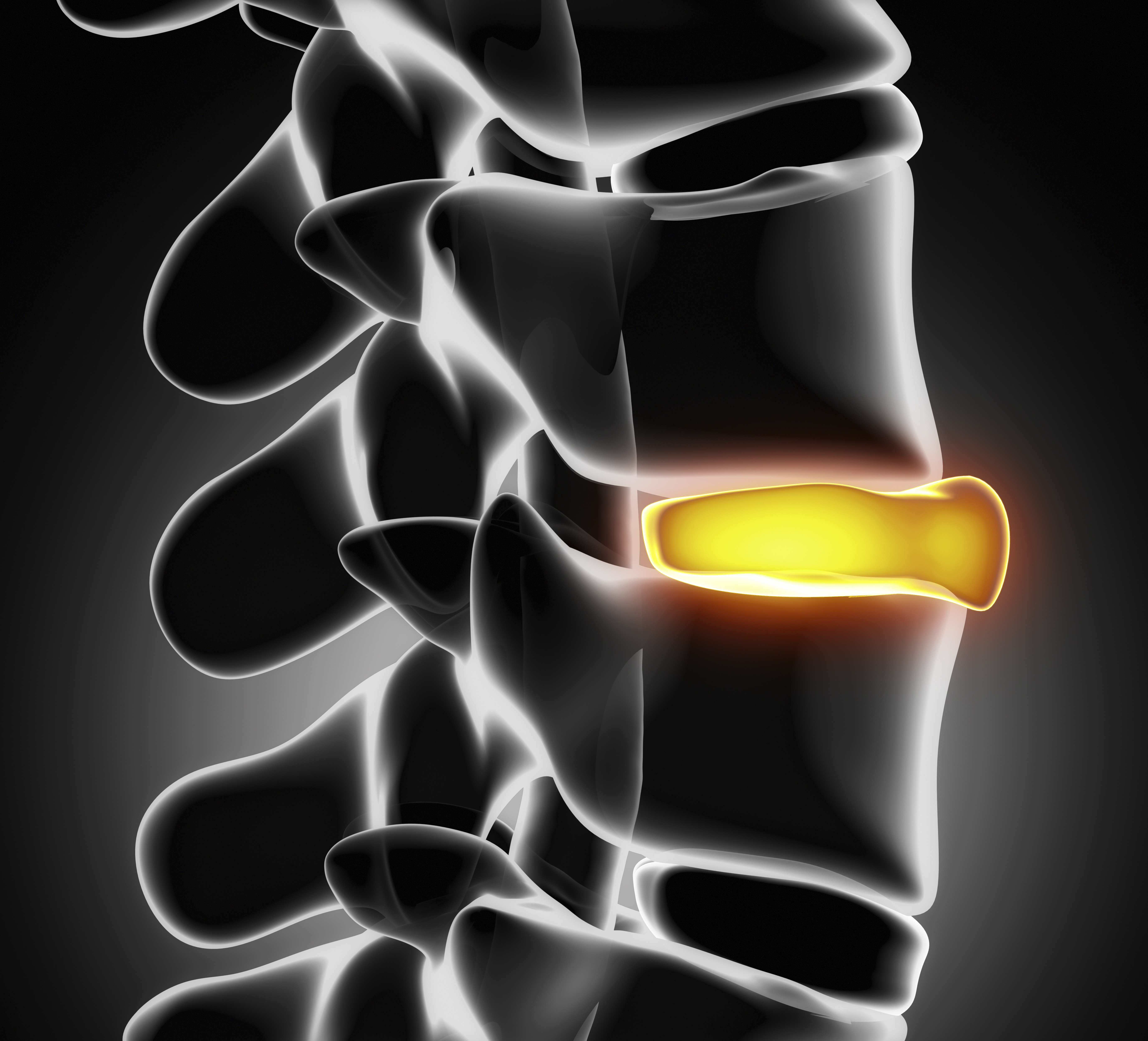 Chiropractic Methods Shown to Be Effective and Less Expensive