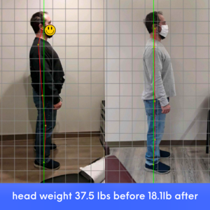 before and after posture