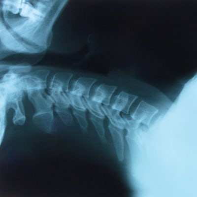 X-ray of neck