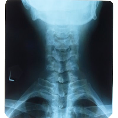 X-ray of neck from rear