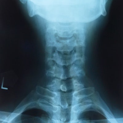 X-ray of neck from rear
