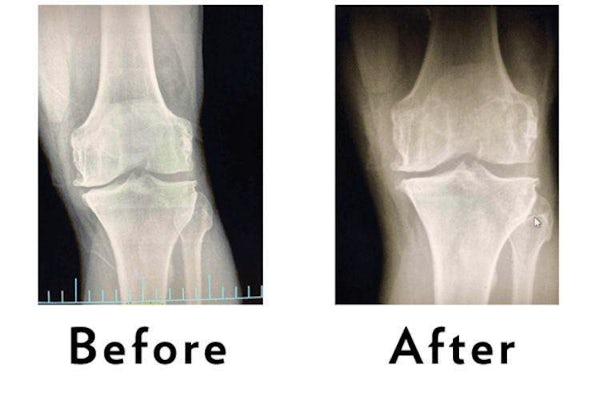 regenerative medicine Wilmington CA