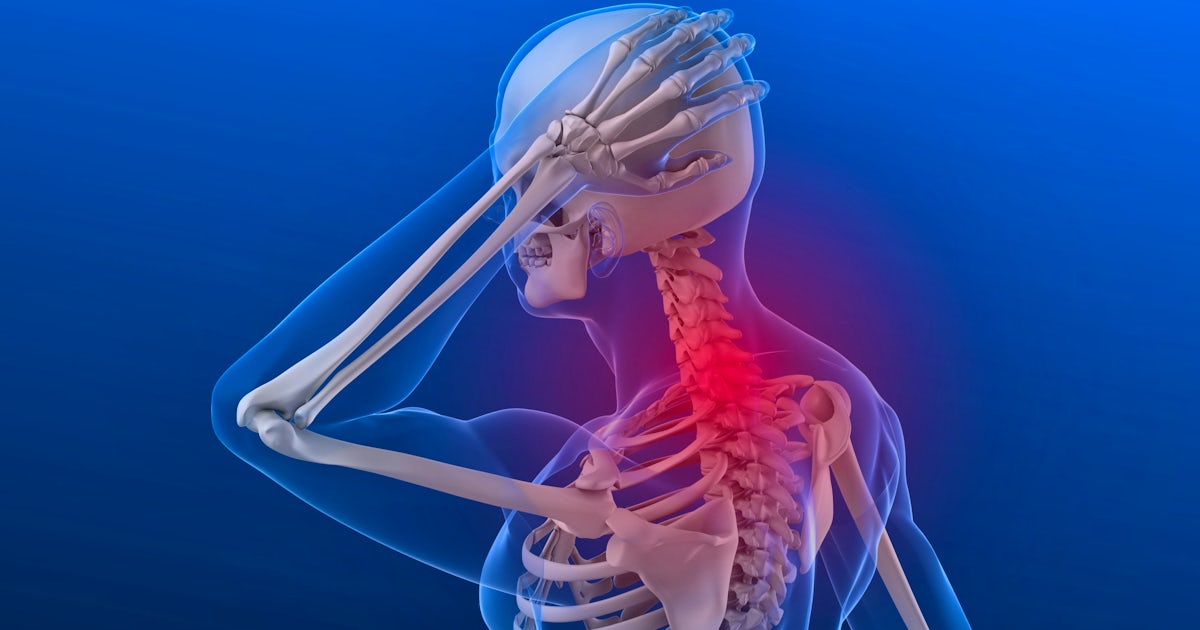 Anatomical model of skeletal system illustrates pain in neck