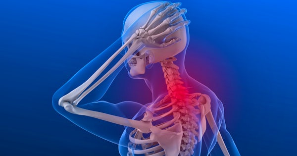 Anatomical model of skeletal system illustrates pain in neck
