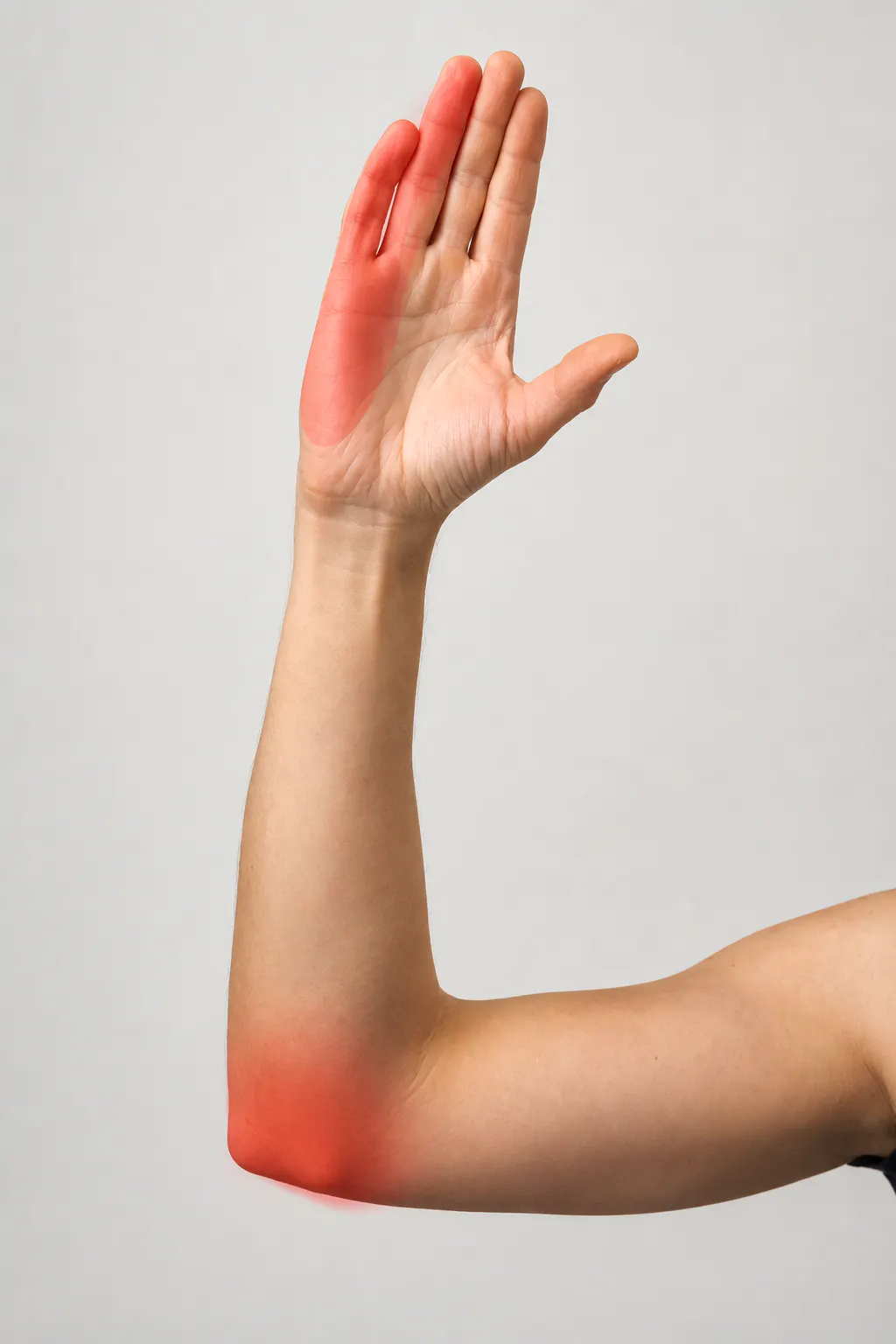Arm and hand with numbness and tingling along the little-finger side from cubital tunnel syndrome