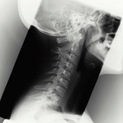 x-ray profile