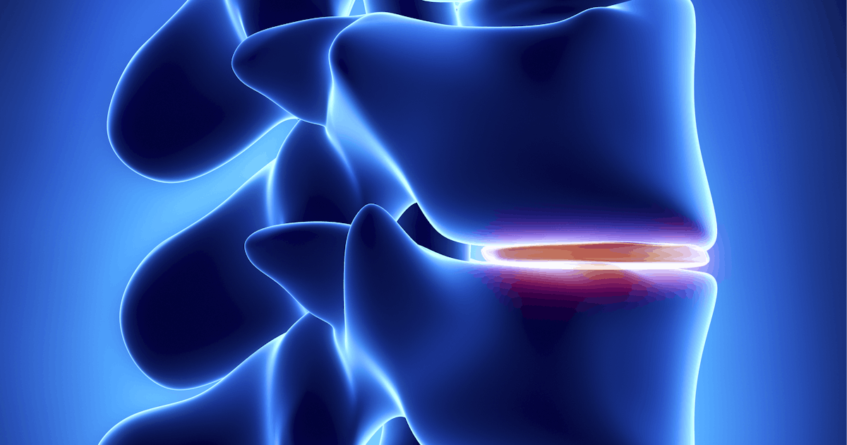 The image shows a close-up view of a human spine, highlighting vertebrae with a glowing effect, emphasizing a specific area of interest.