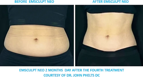 Abs Front Results