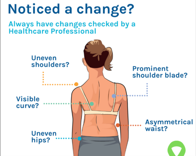 an infographic of a teenager, of her back, pointing out spots of concern of when a teenager or a child might want to see a chiropractor