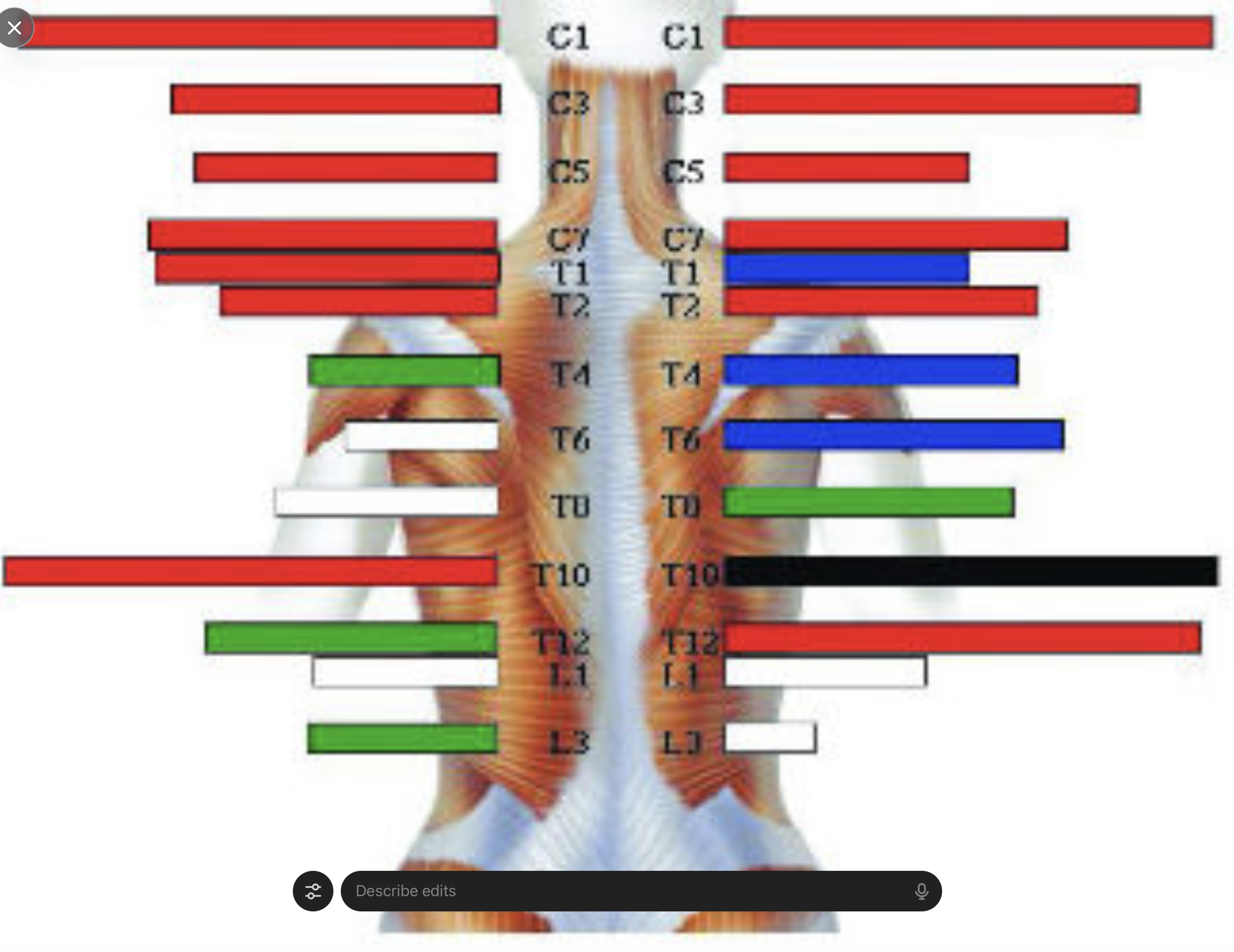Computerized EMG scan assessing spinal muscle and nerve function at chiropractor in Oakleigh and surrounding suburbs