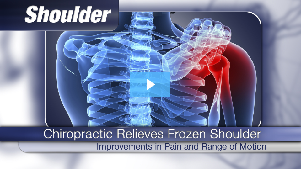 Frozen Shoulder Syndrome Eased By Chiropractic