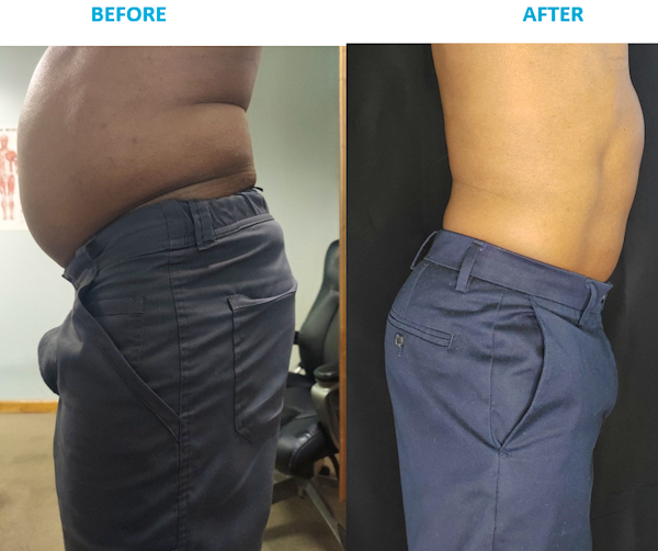 Dr. Phelts' before and after photos.  He is an expert in weight loss and body transformation