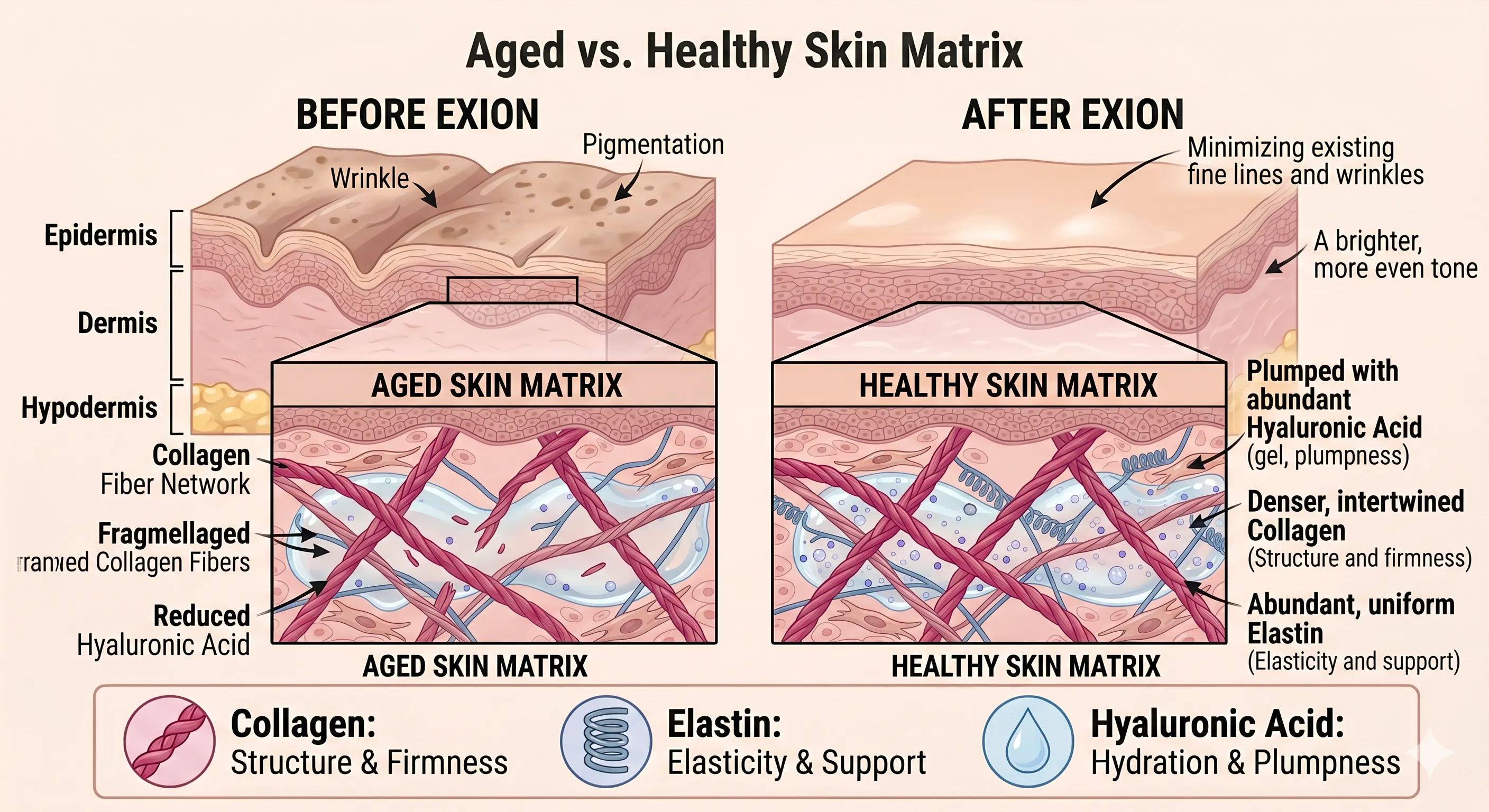 Exion Face Before and After