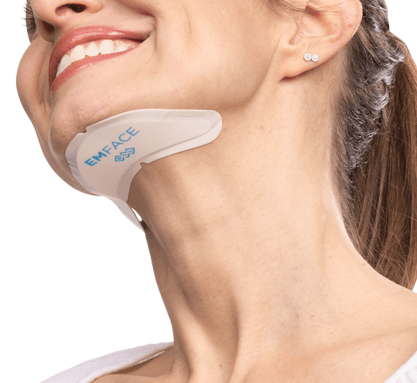 EMFACE reduce double chin 36%