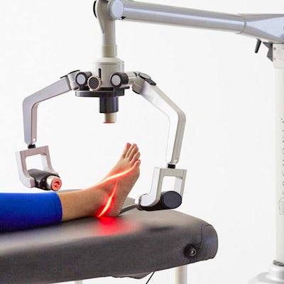 laser treatment on foot