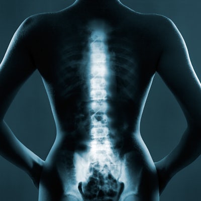 xray image of back of female body