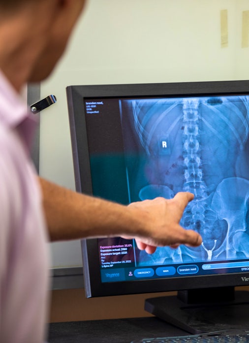 chiropractor pointing to x-ray