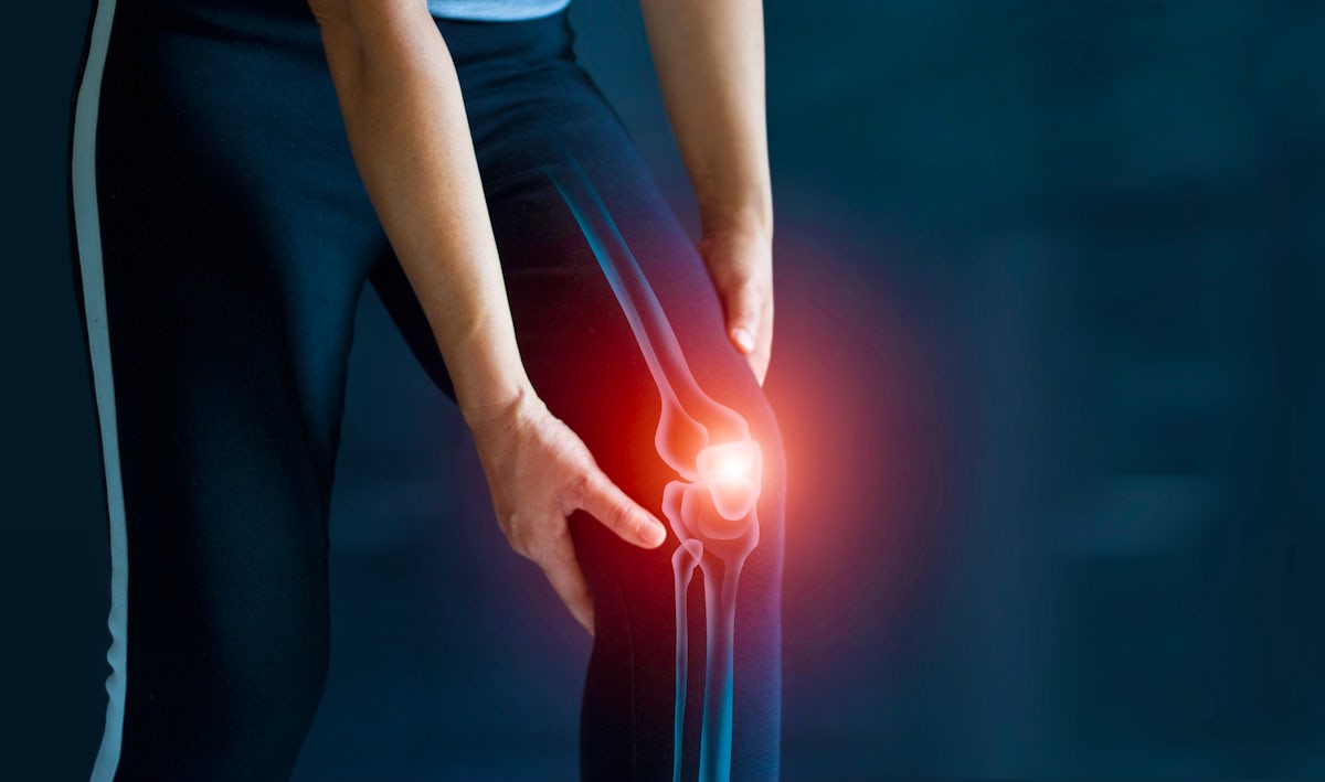 Sport woman suffering from pain in knee. Tendon pr