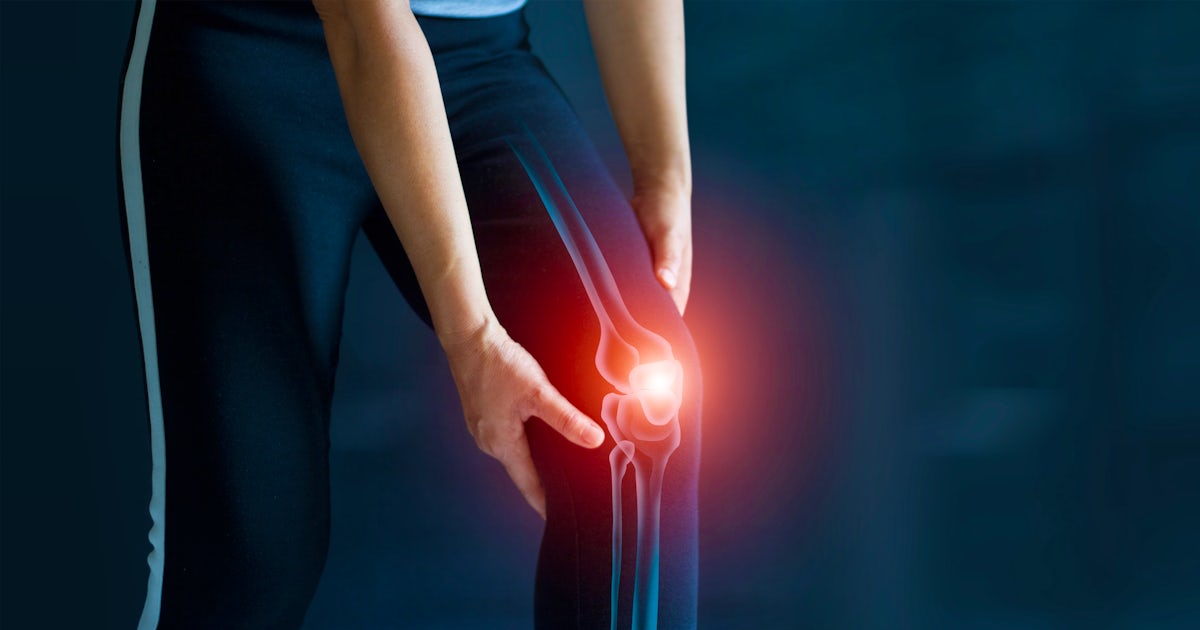 Sport woman suffering from pain in knee. Tendon pr