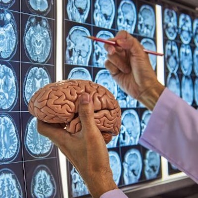 doctor points to frames from MRI scan while holding brain model in other hand