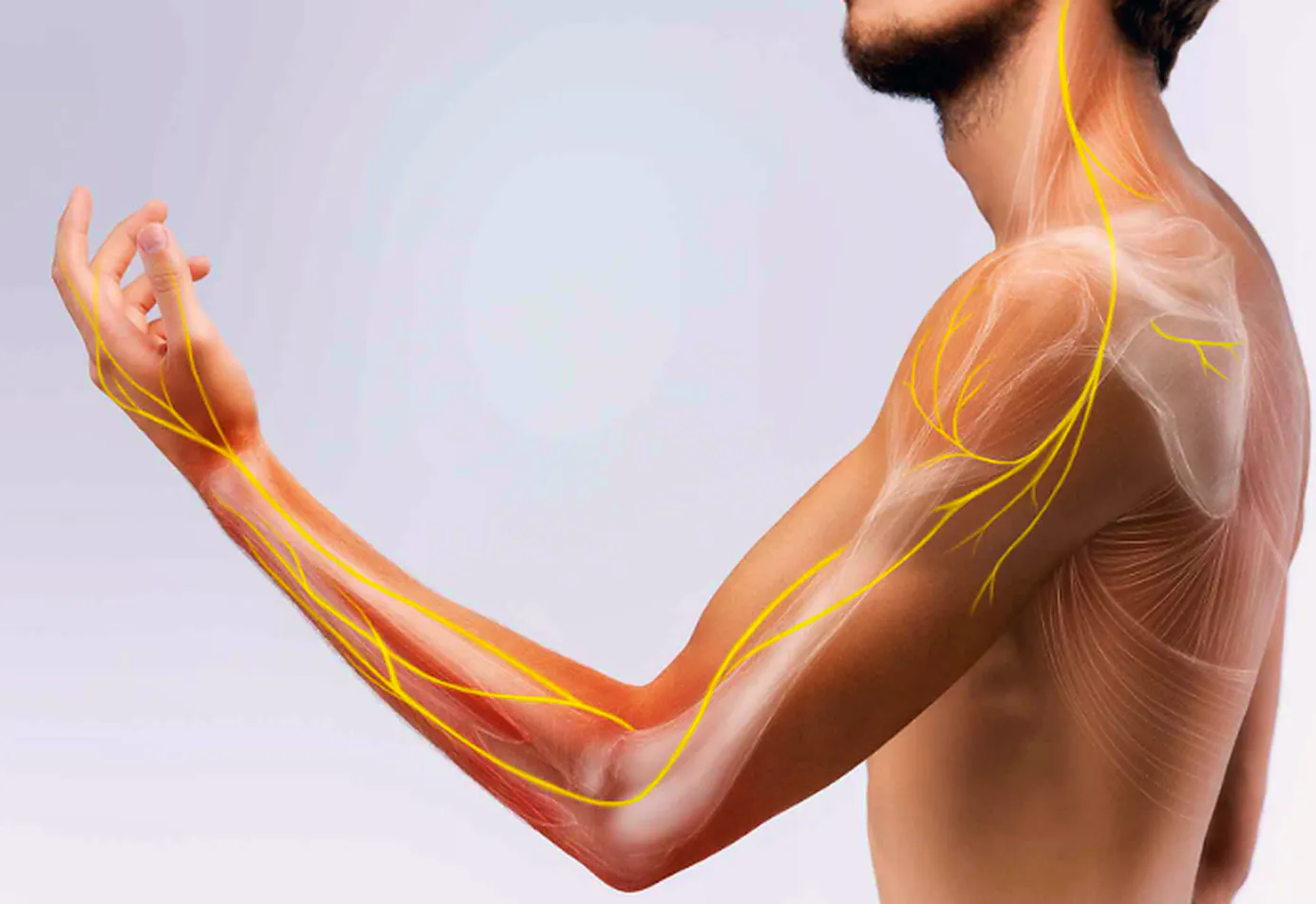 Nerve pathways highlighted from the neck through the shoulder and arm in thoracic outlet syndrome