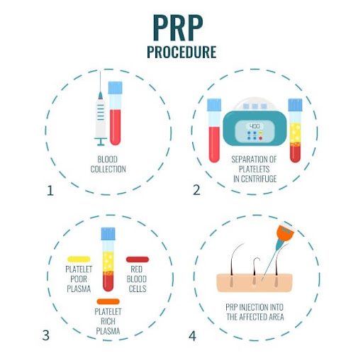 simple peptide tirzepatide Simple Peptide Tirzepeptide 30 Mg