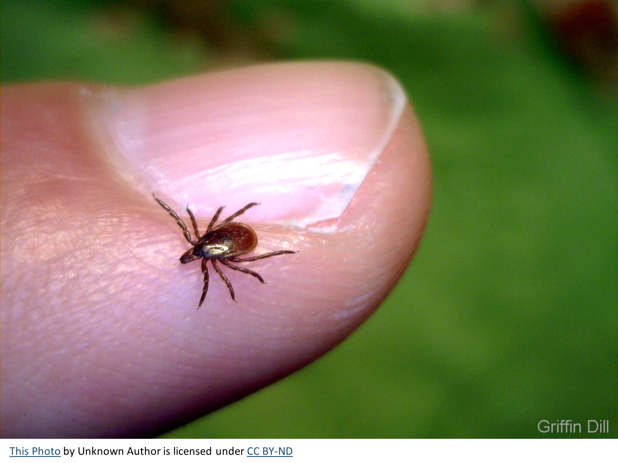 Dealing With Posttreatment Lyme Disease Syndrome New York, NY