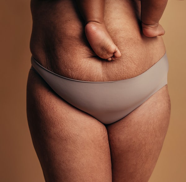 EMSculpt NEO can help strengthen your abdomen and get your pre-pregnancy body back