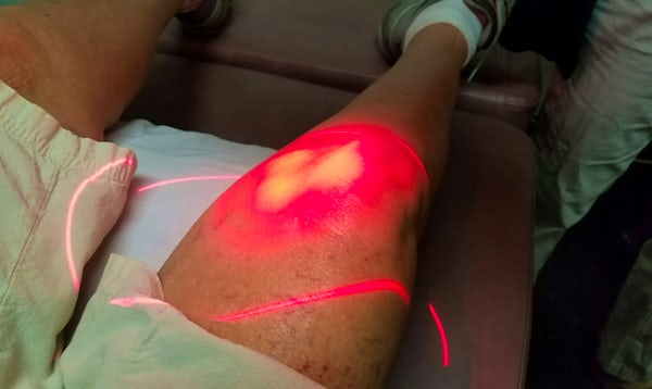 laser