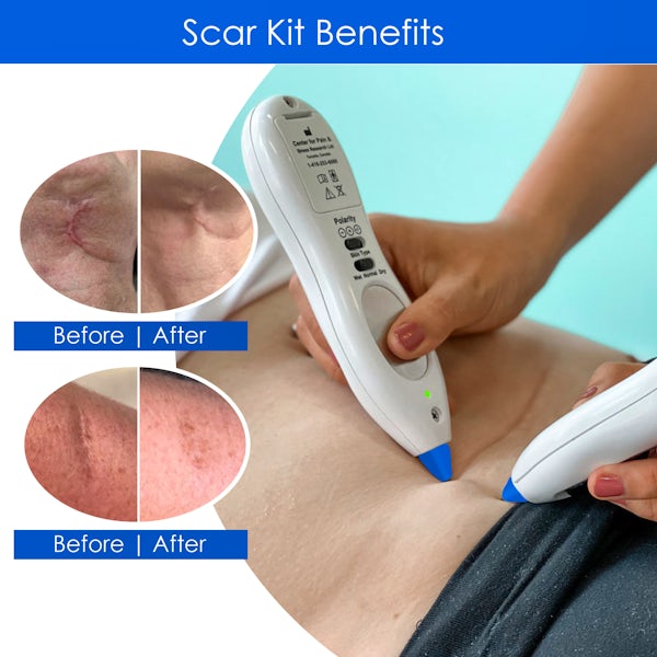 C-Section Scar Release Therapy