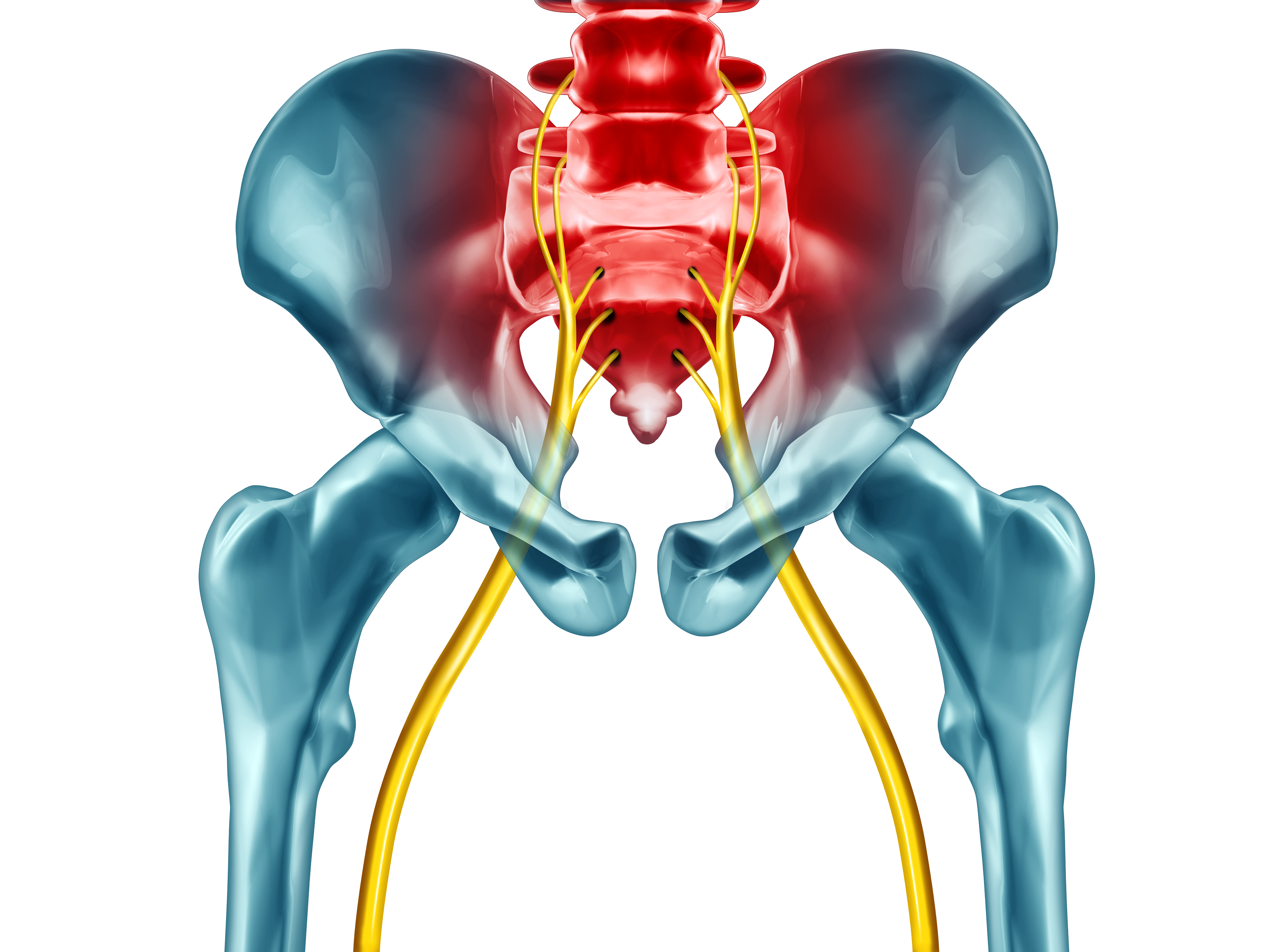 Chiropractic Extremely Effective For Lower Back Pain And The Sacroiliac   Sciatica 005 