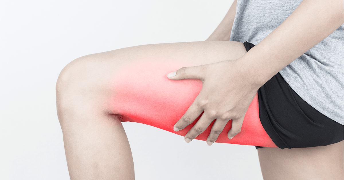 The image shows a person in a gray shirt and black shorts holding their thigh, which has a gradient of red shading.