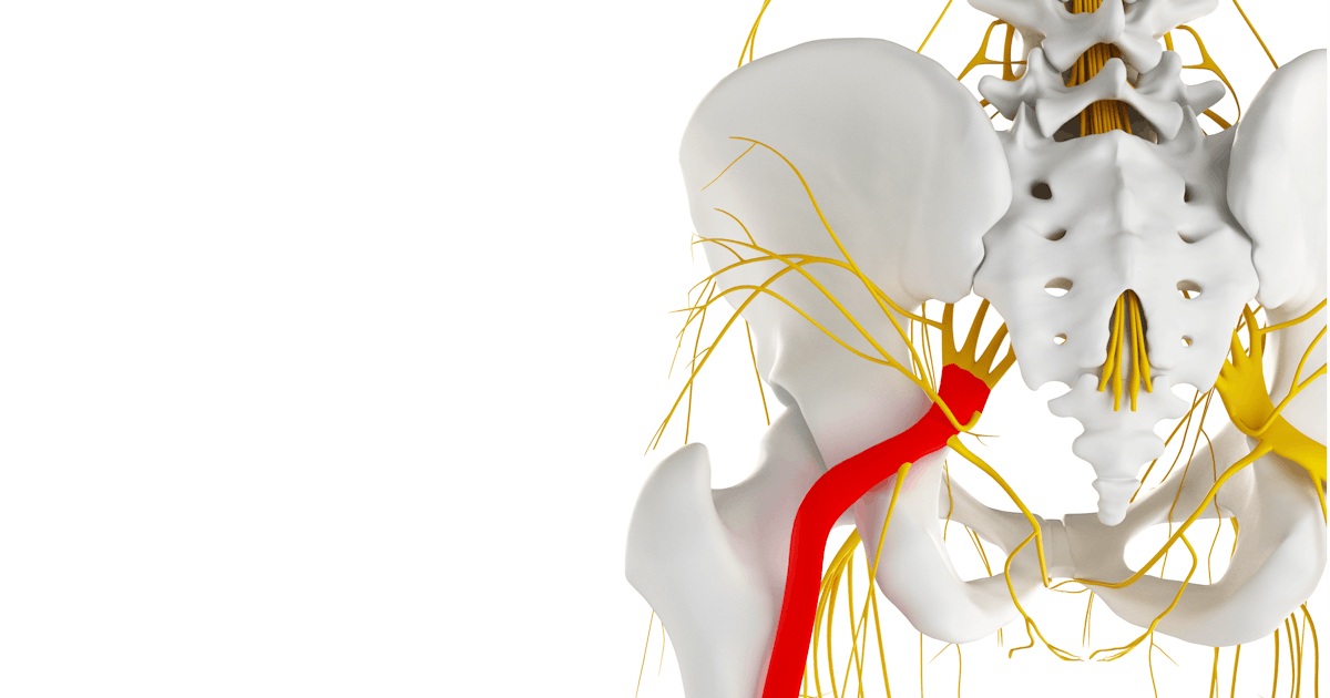 The image depicts a human skeletal structure with highlighted nerves, particularly the sciatic nerve in red, among other yellow nerve pathways.