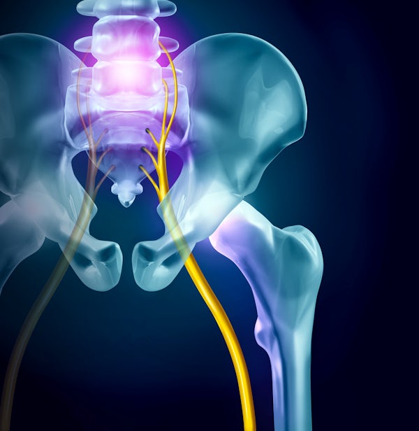 The image depicts a stylized representation of the human pelvis, highlighting the spine and associated nerves.