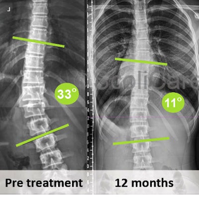 x-ray