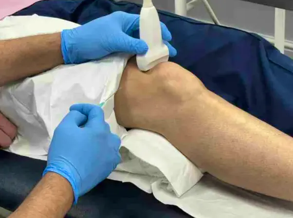 Clinical assessment of swelling at the front of the knee