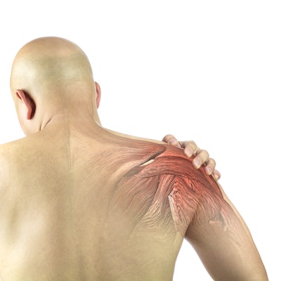 back of upper half male body left hand grabbing right shoulder pain glowing red