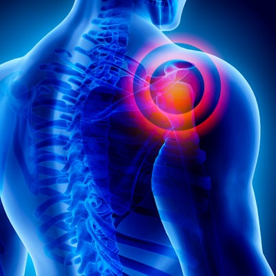 The image depicts a digital illustration of a human back and shoulder with a highlighted area indicating pain or discomfort in the shoulder region.