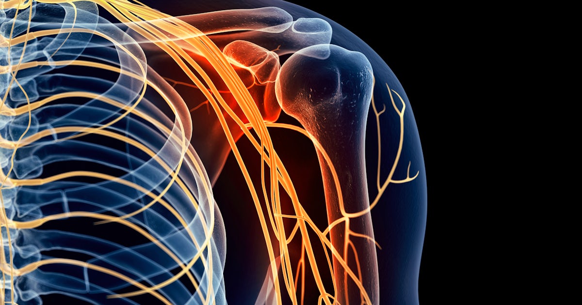 Illustration of shoulder anatomy highlighting the nerves