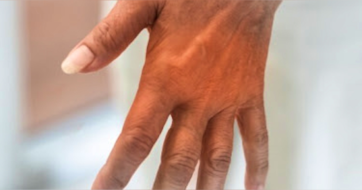 hand nerve damage