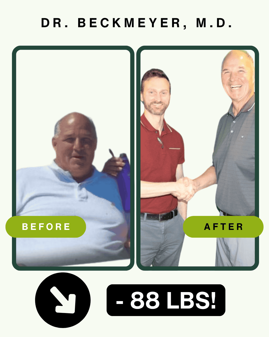 Dr. Beckmeyer before and after weight loss