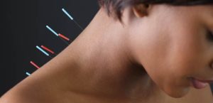 about-acupuncture