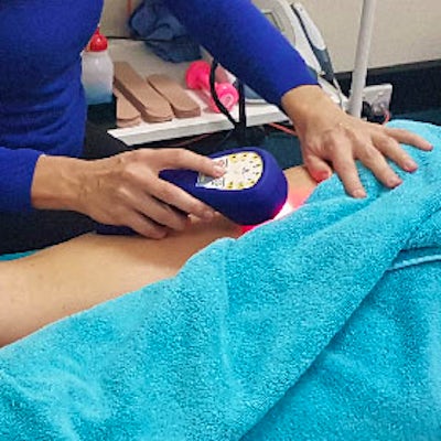 laser therapy