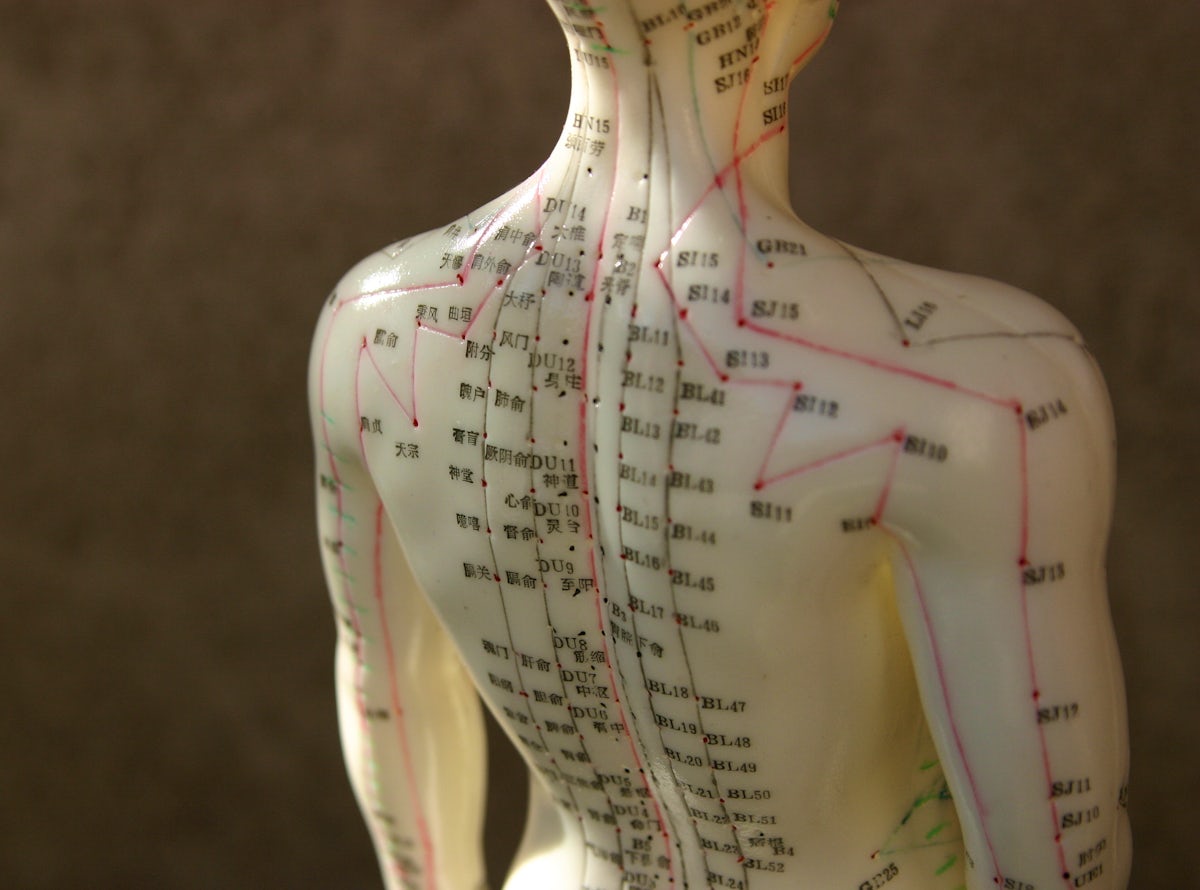 acupuncture
