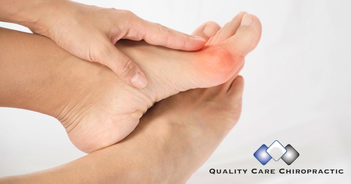 Bunion: Strengthening Foot Muscles To Reduce Pain and Improve