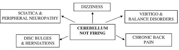 cerebellum not working