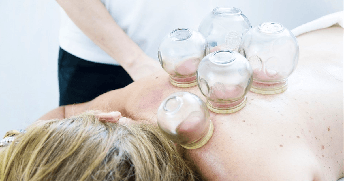 Functional Cupping Adelaide