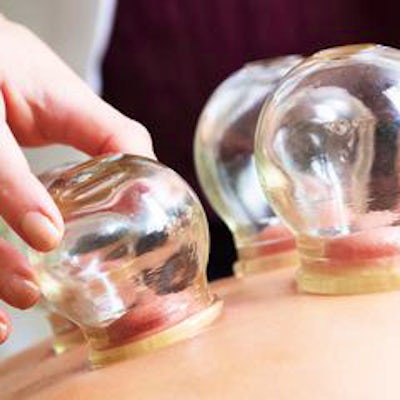 cupping